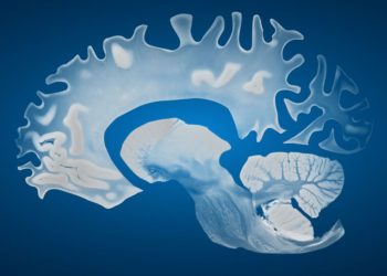 MRI scans showing age-related brain changes and gender brain differences.