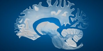 MRI scans showing age-related brain changes and gender brain differences.