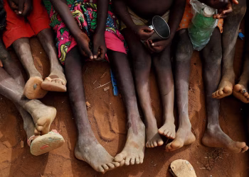 How to aid Sudan by helping malnourished children and ending child hunger Sudan crisis.