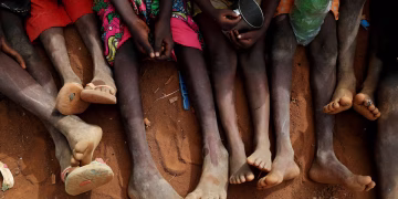 How to aid Sudan by helping malnourished children and ending child hunger Sudan crisis.
